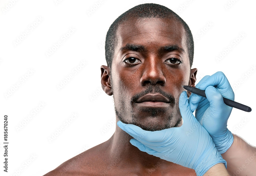 Ethnic rhinoplasty needs to be an exceptional surgical experience.