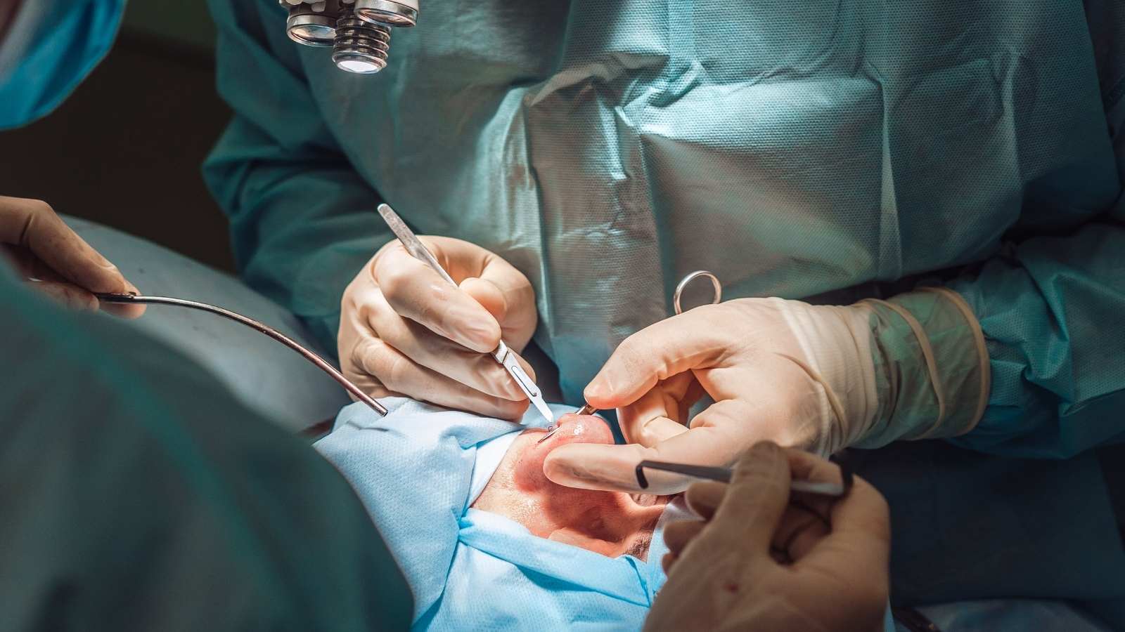 Burun Kemiği Törpüleme Ameliyatı | Dr. Seçkin Ulusoy