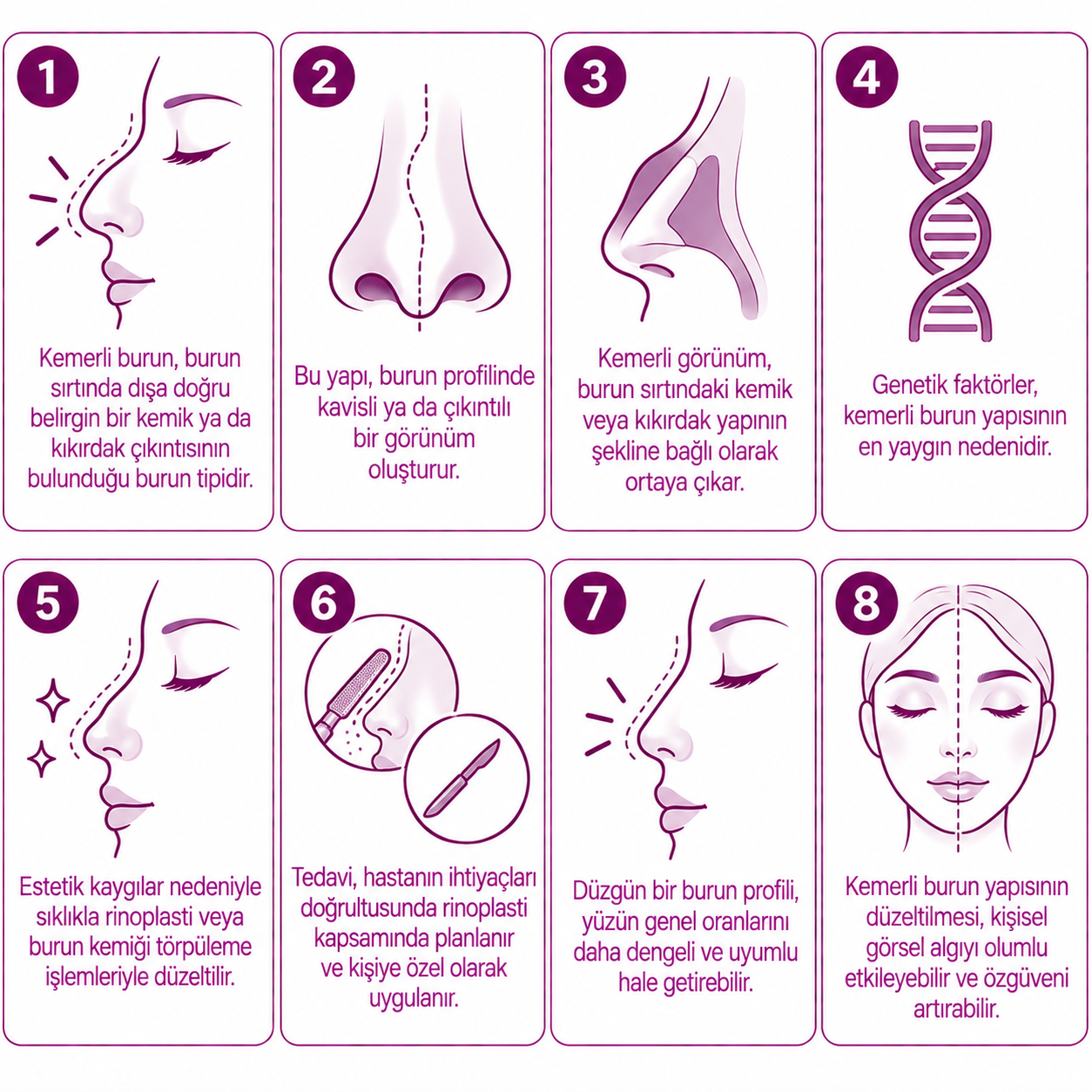 Kemerli Burun Nedir?