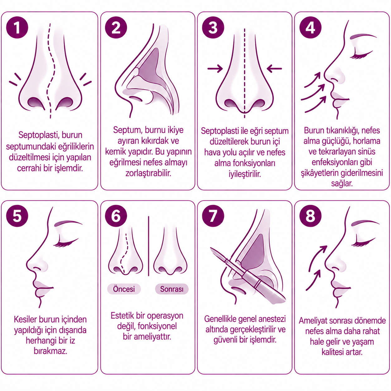 Septoplasti Nedir?